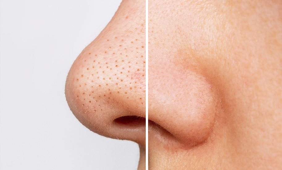 654205ff08c54-siyah-nokta-detay