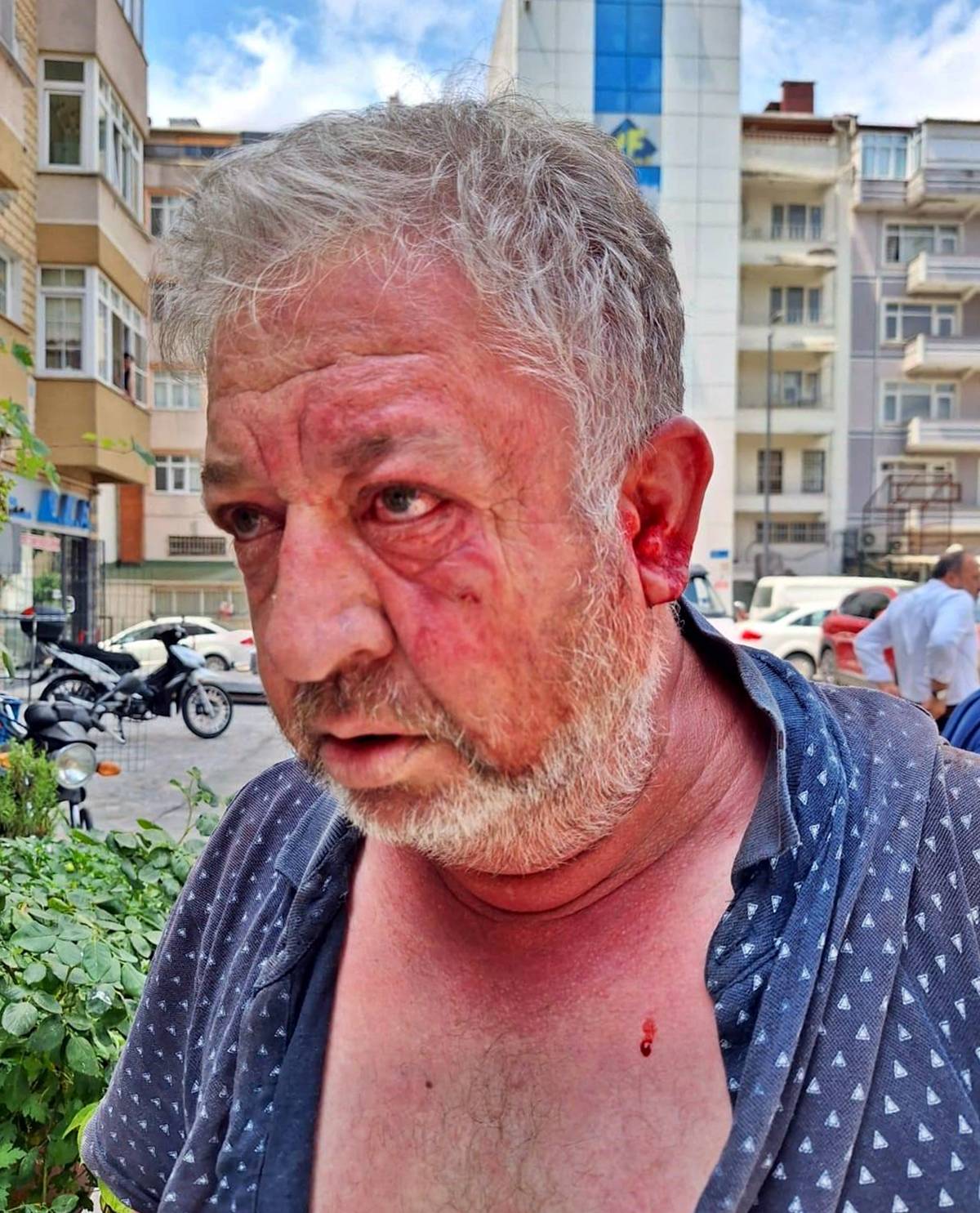 tekirdag-cerkezkoy-son-dakika-haberleri-2