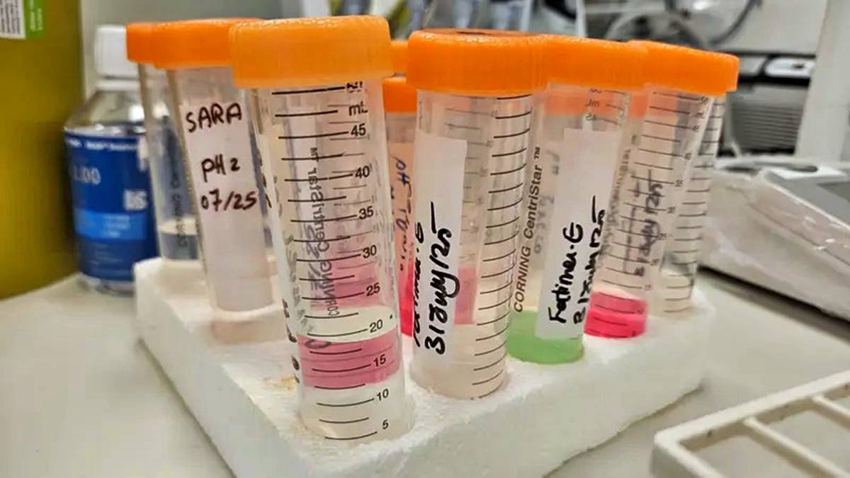 dis-macunu-saca-surulurse-ne-olur-dis-macunu-faydali-mi-3