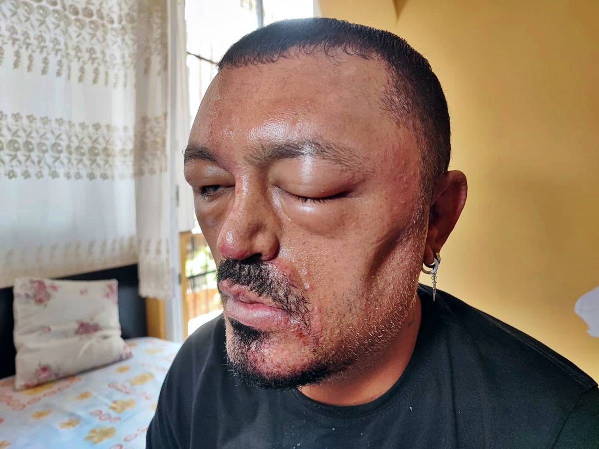 sac-boyasi-sagliga-zararli-mi-2