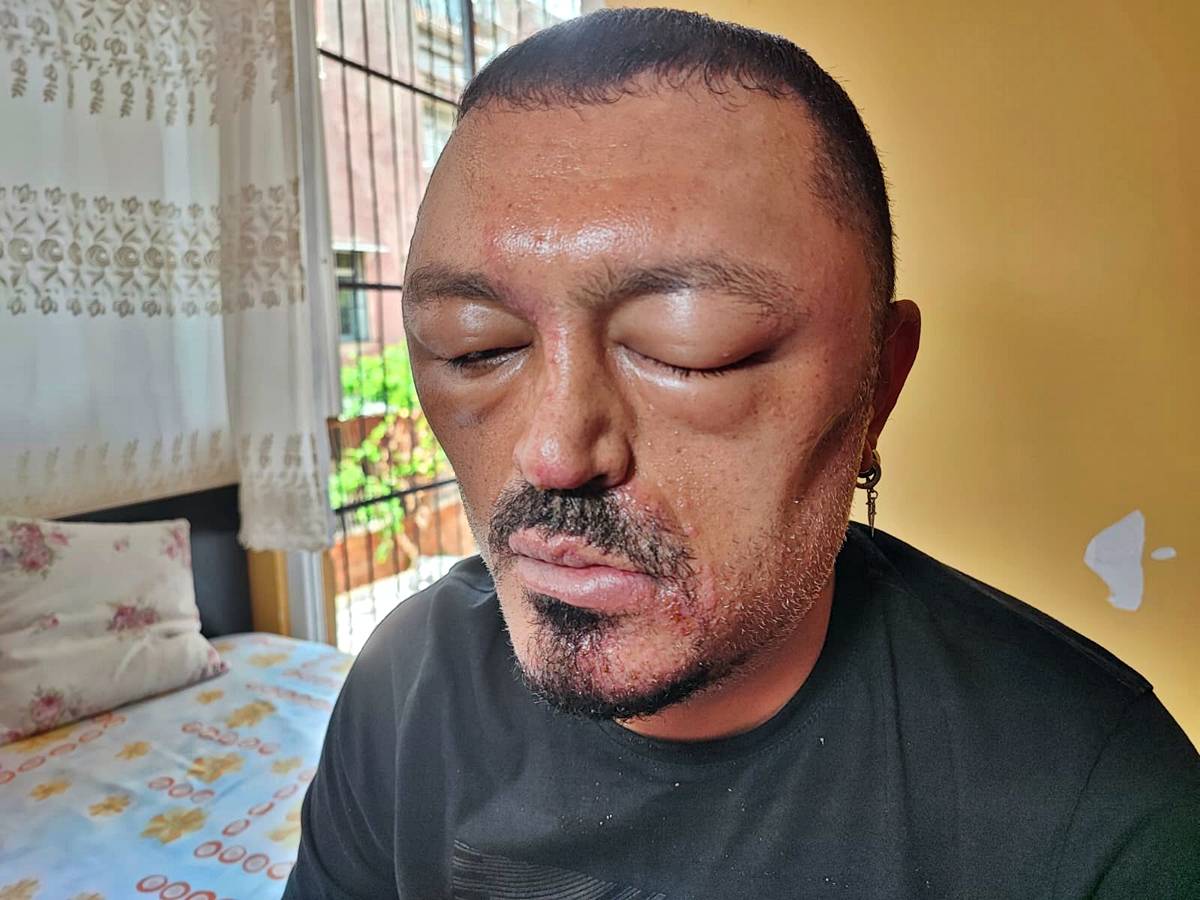 sac-boyasi-sagliga-zararli-mi-3