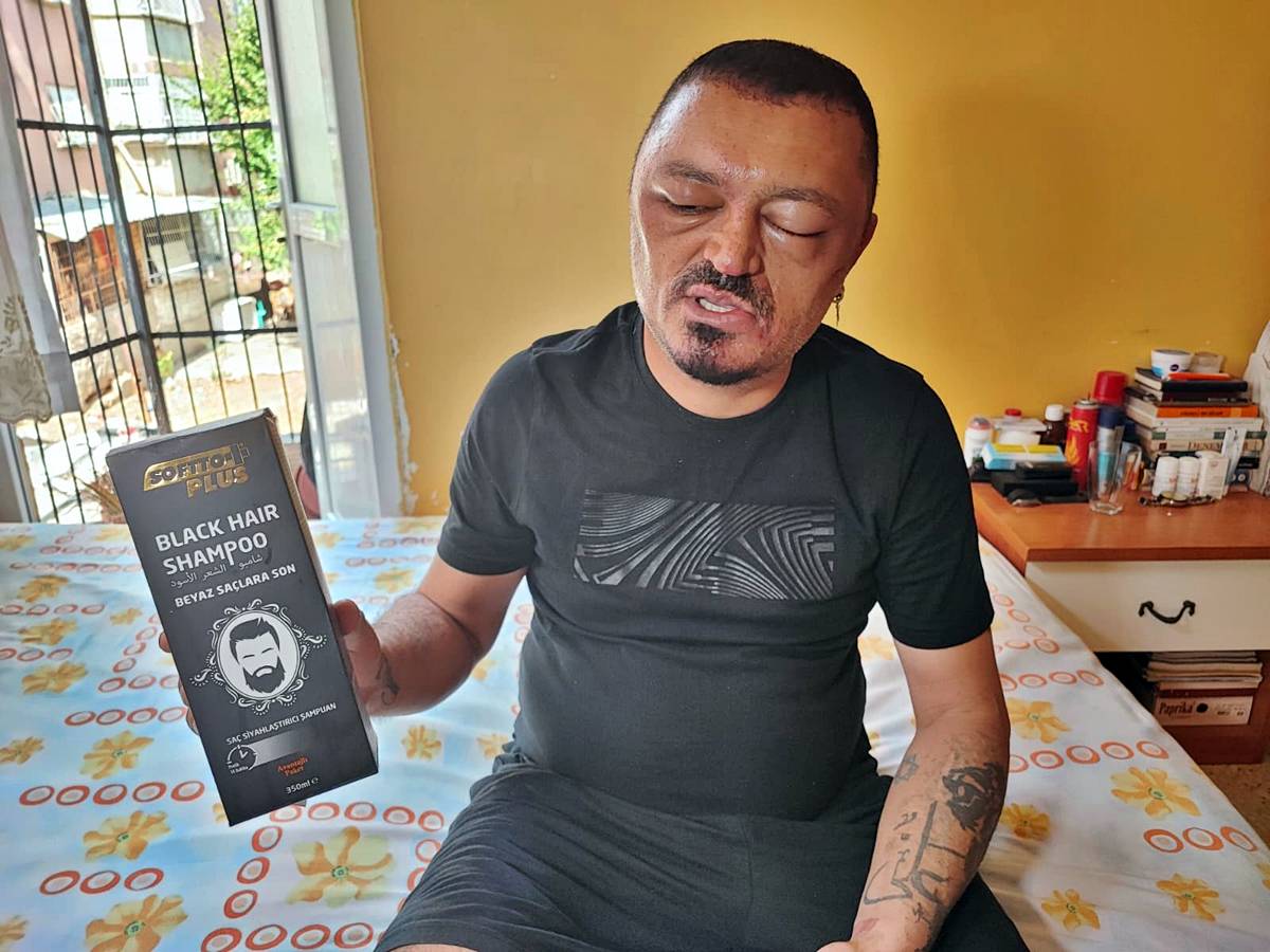 sac-boyasi-sagliga-zararli-mi-4