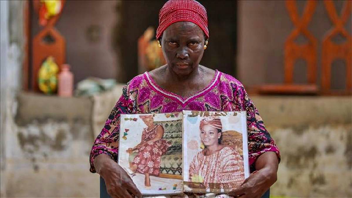 ten-rengi-nasil-acilir-ten-rengi-actirmak-zararli-mi-1