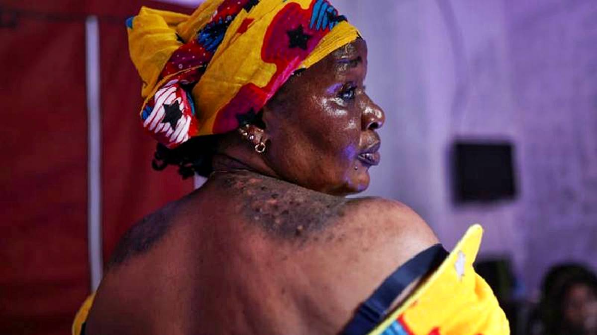 ten-rengi-nasil-acilir-ten-rengi-actirmak-zararli-mi-2