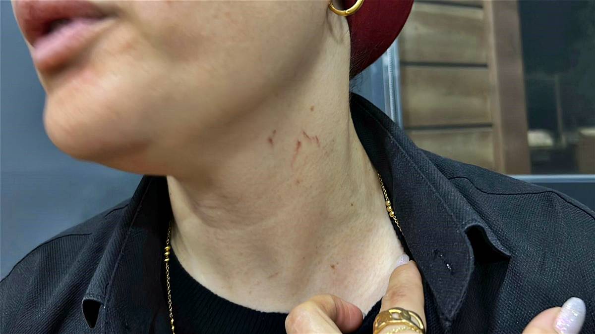 hatay-esin-solist-kimdir-kac-yasinda-aslen-nereli-3