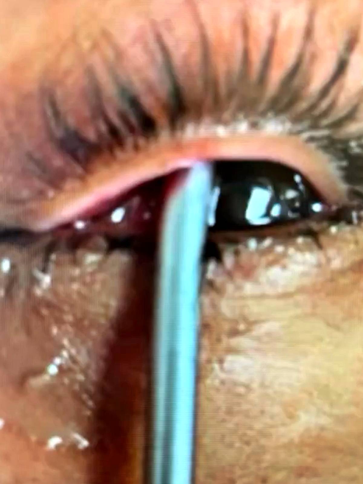 is-kazasi-tornavida-gozune-saplandi-2