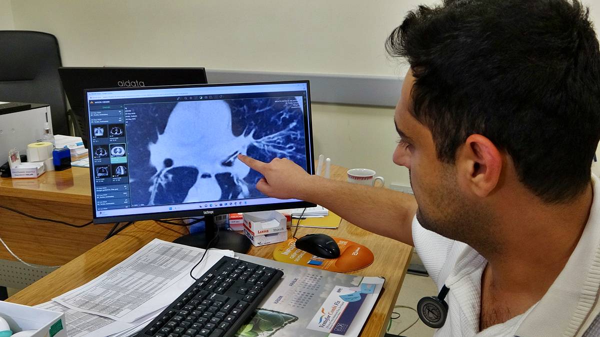 kansersin-astimsin-dediler-akcigerinden-kabak-cekirdegi-cikti-1