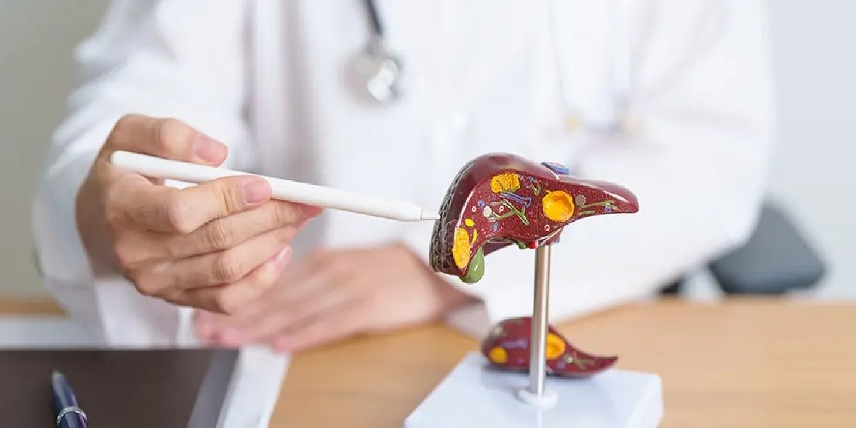 karaciger-yaglanmasi-1