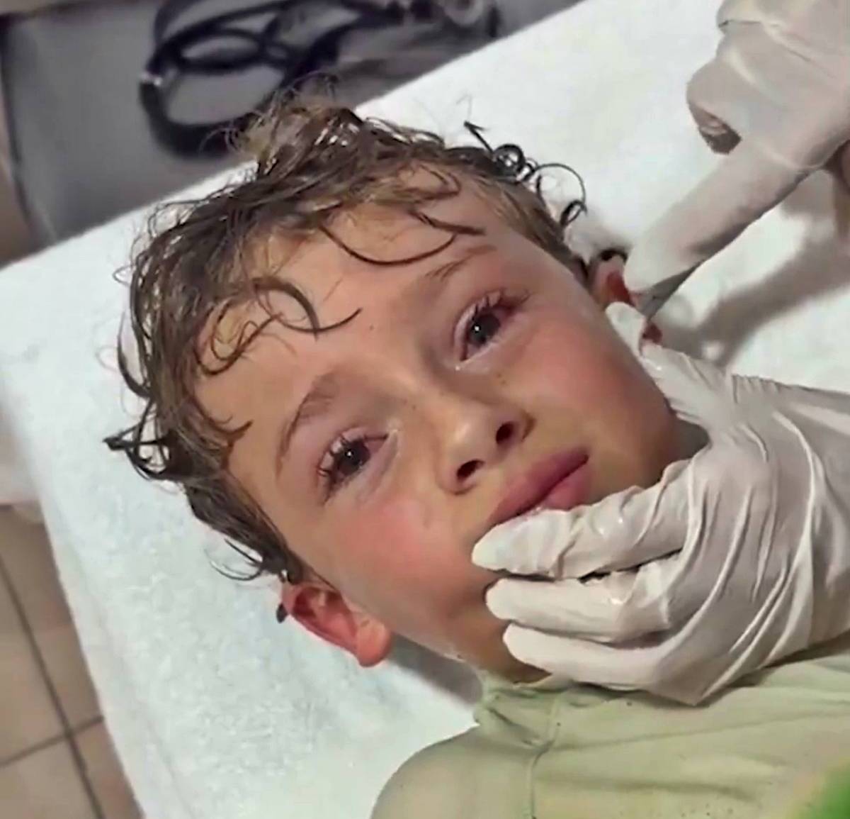 kulagindan-yengec-cikan-cocuk-5