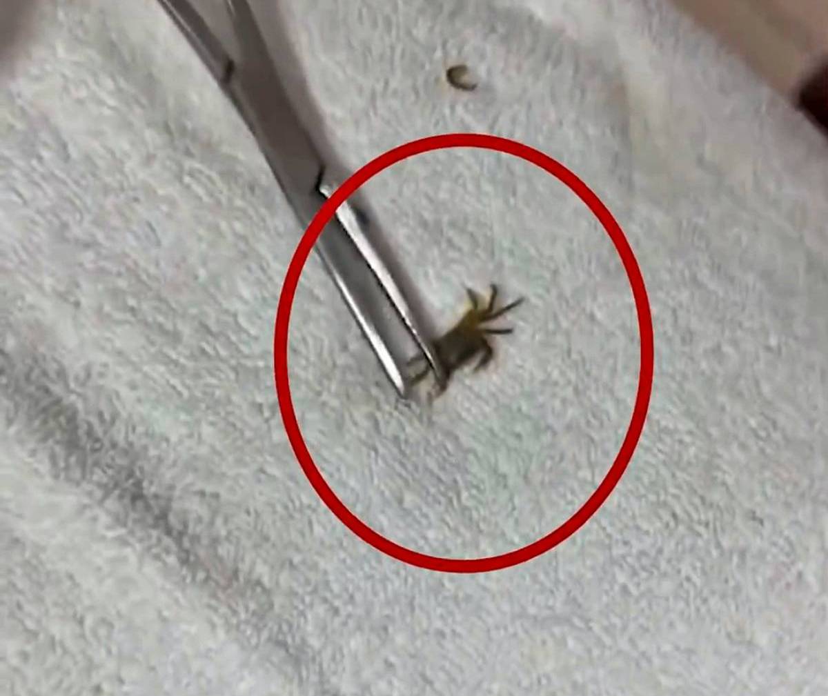 kulagindan-yengec-cikan-cocuk-6