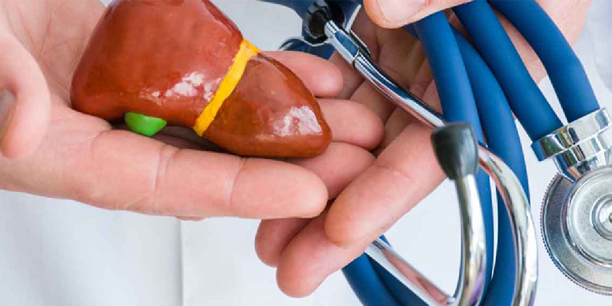 karaciger-yaglanmasi-2