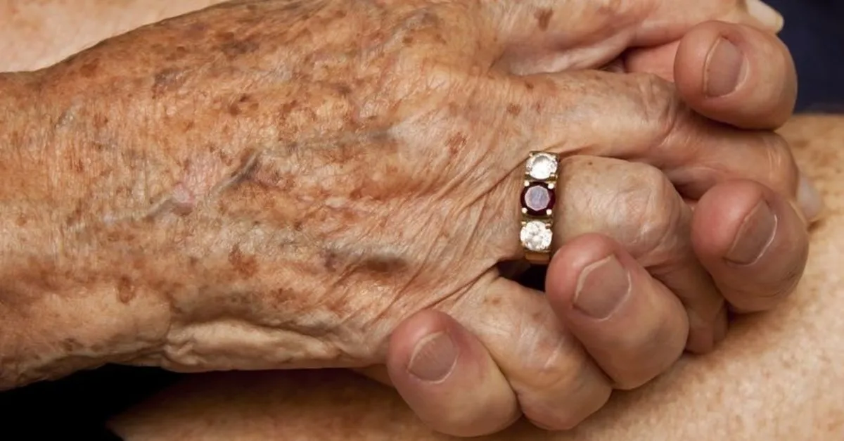 1200x627-yaslilik-lekeleri-nasil-giderilir-yuzdeki-ve-eldeki-kahverengi-yaslilik-lekeleri-nasil-gecer-rs1-1693484813707.webp