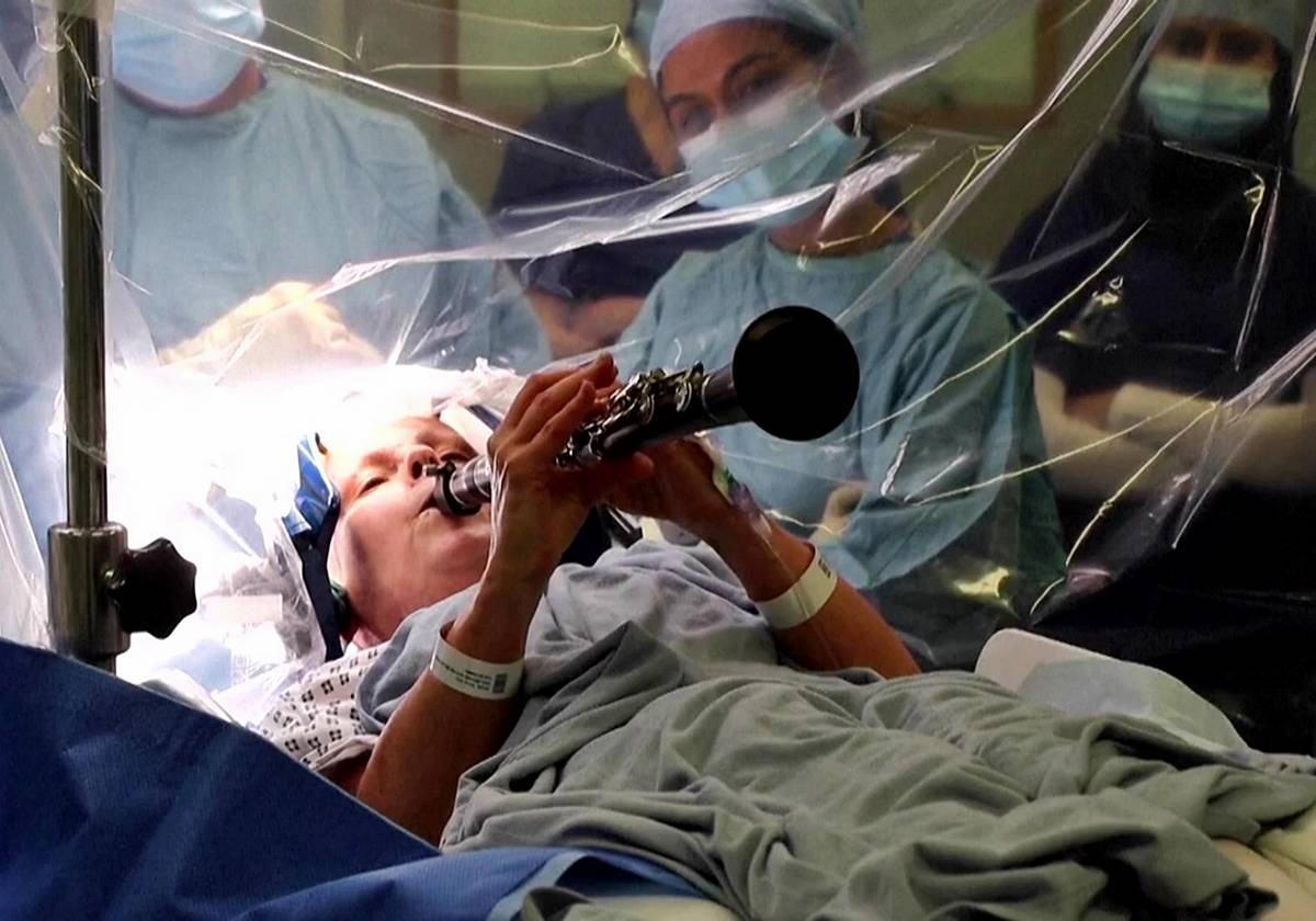 parkinson-hastasi-beyin-ameliyati-olurken-klarnet-caldi-3.jpg
