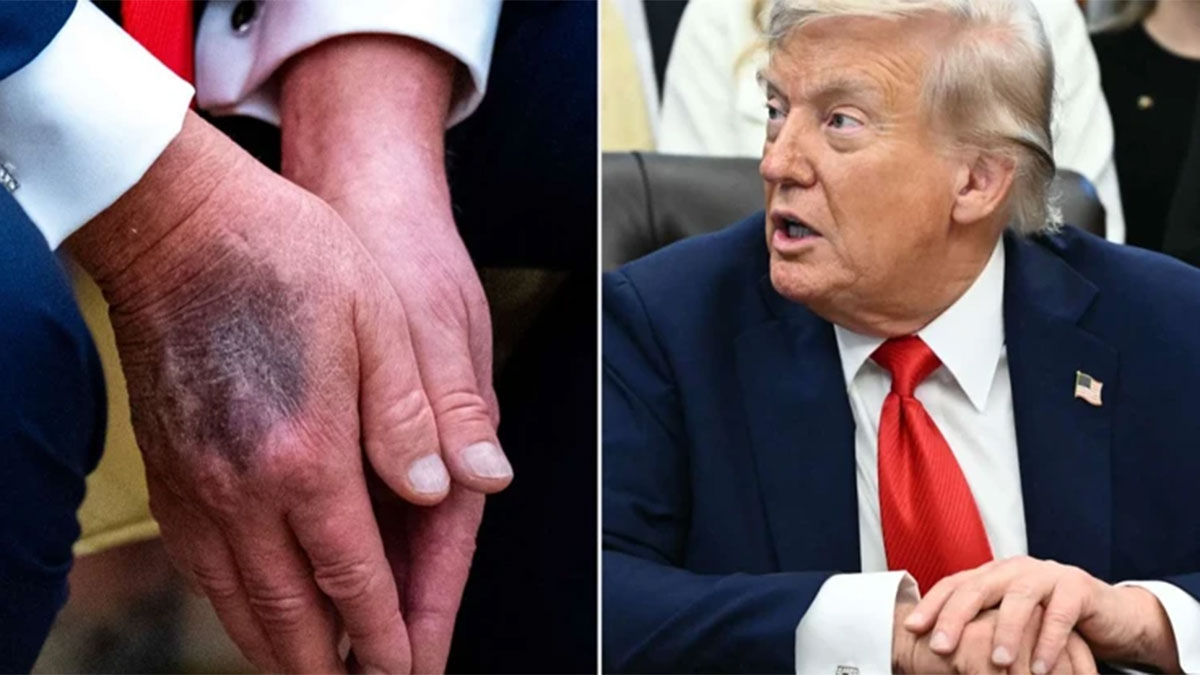 trump-morluk.jpg