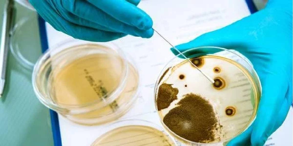 listeria-bakterisi-nedir-1.jpg